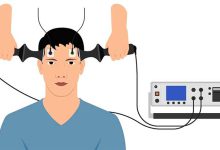 از دست دادن حافظه بر اثر شوک و تاثیر شوک درمانی بر حافظه