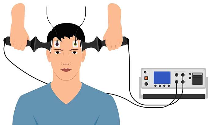 از دست دادن حافظه بر اثر شوک و تاثیر شوک درمانی بر حافظه