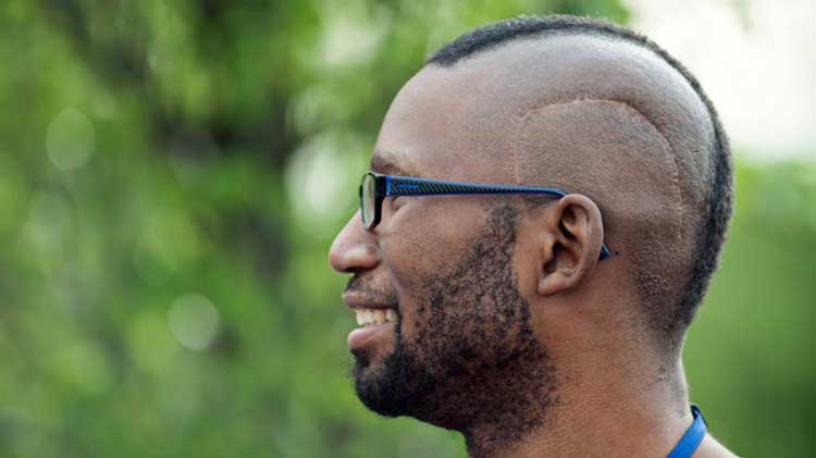 عکس جراحی مغز